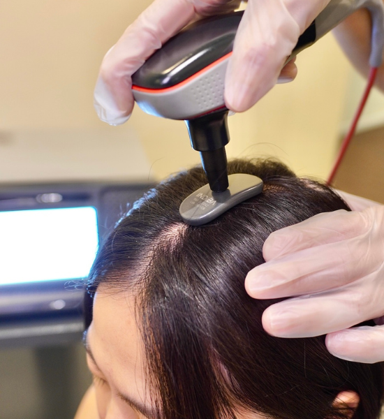Best Anti-Ageing Scalp Treatment - Svenson